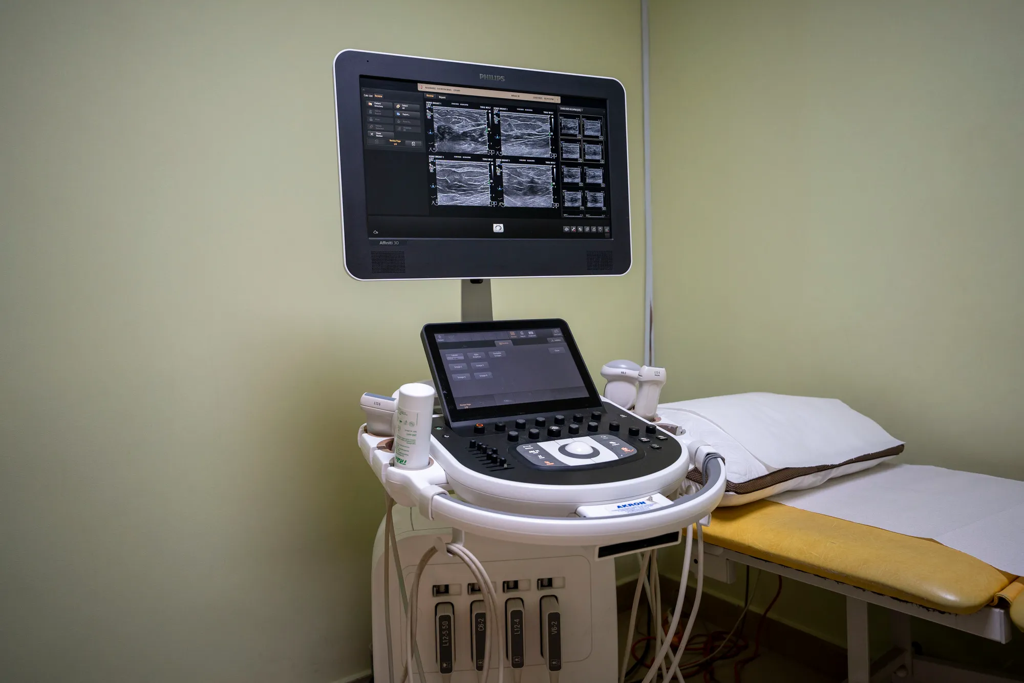 Ultrasound – High-Resolution Imaging
