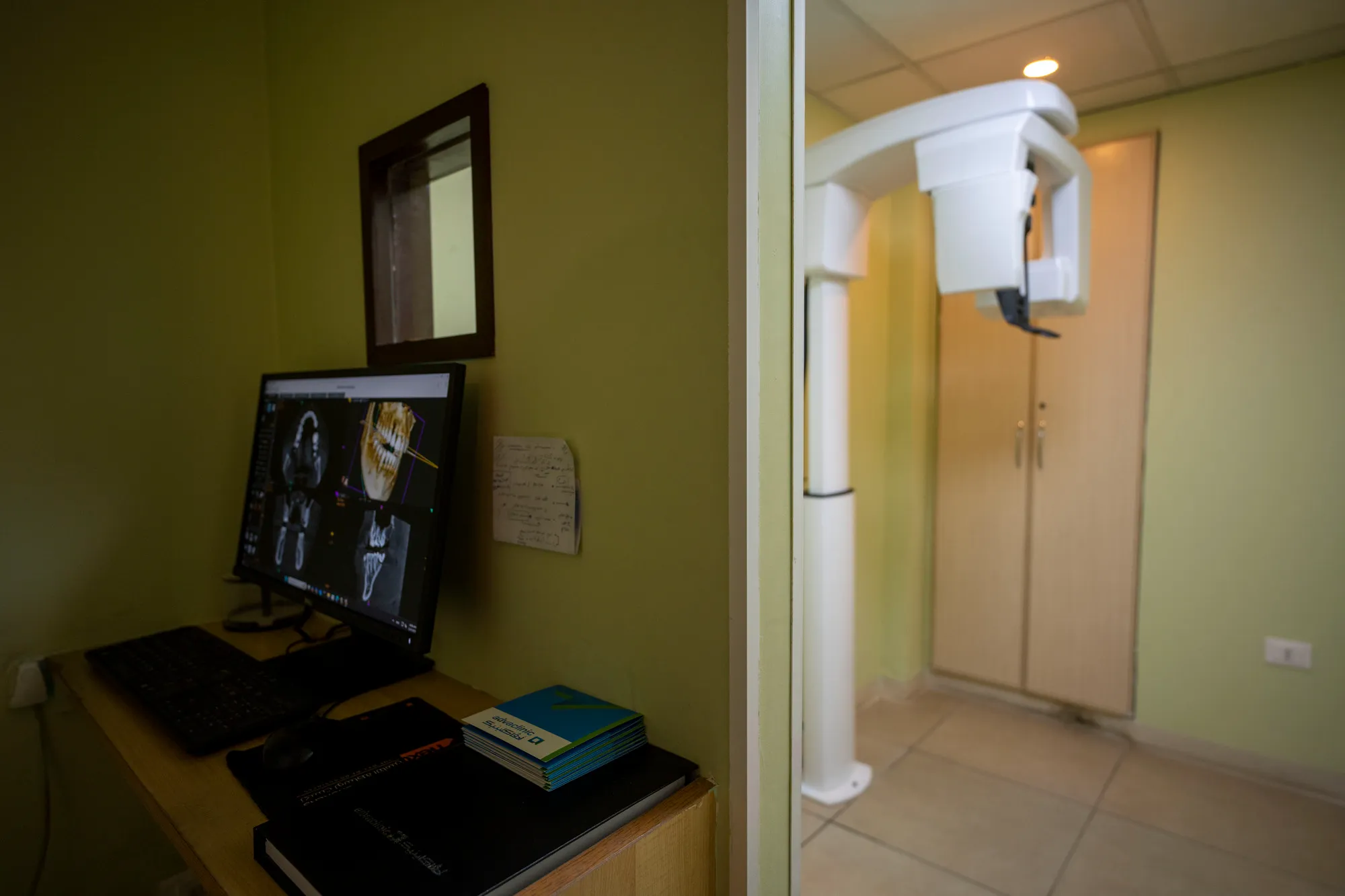 Panoramic X-Ray – Dental Imaging