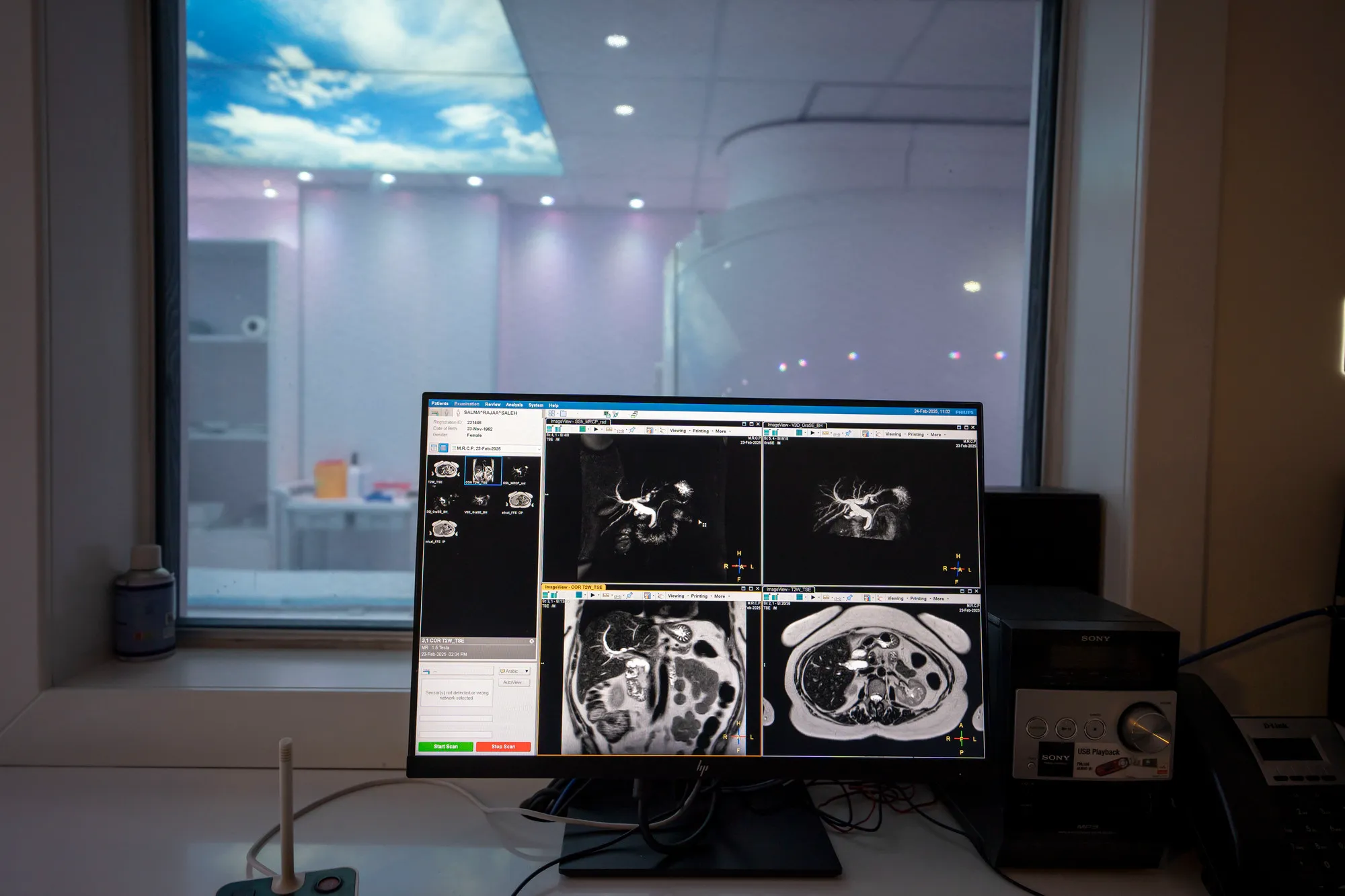 CBCT – Biopsy and Advanced Imaging